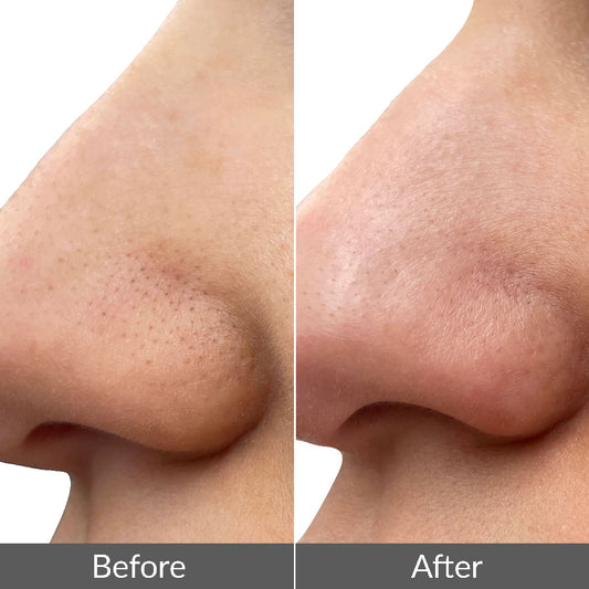 Skin Aura Pro